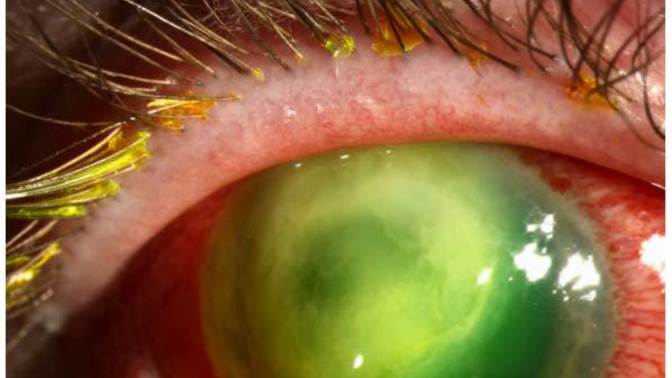 Have You Experienced High Risk Diseases?