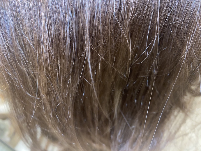 Do I have breakage and is my hair healthy?