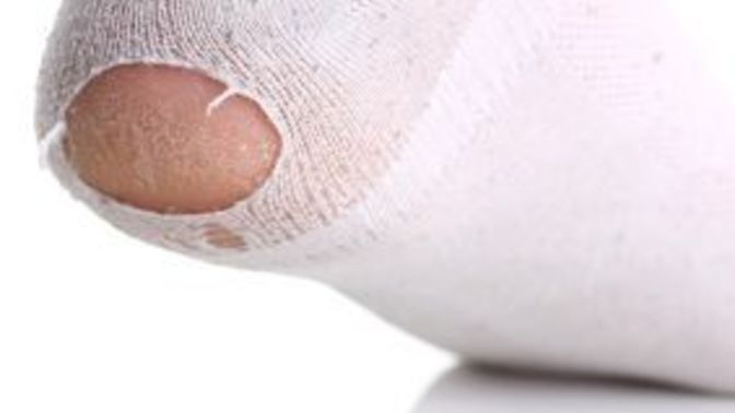 Do you still wear your socks if there is a hole in them?