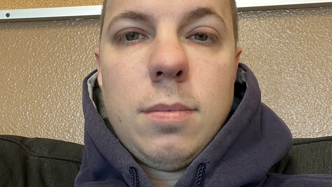 Am I too ugly to date for my age I’m 30?