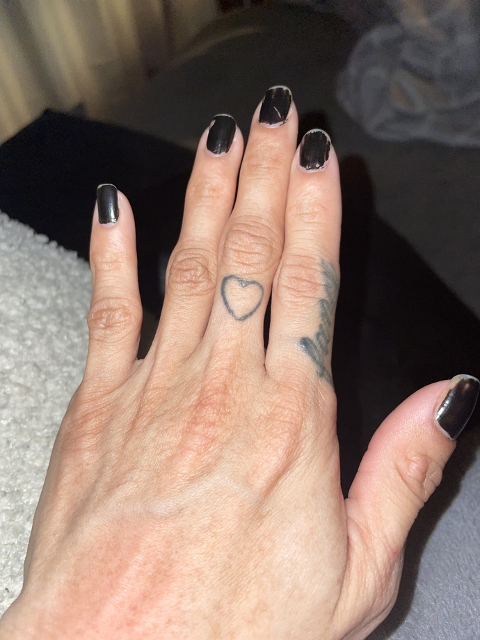 POLL- SHOULD I REMOVE MY FINGER TATTOO?
