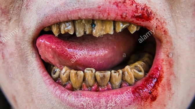 If a guy is good-looking and has a decent, funny, personality, but bad teeth, would you still kiss him?
