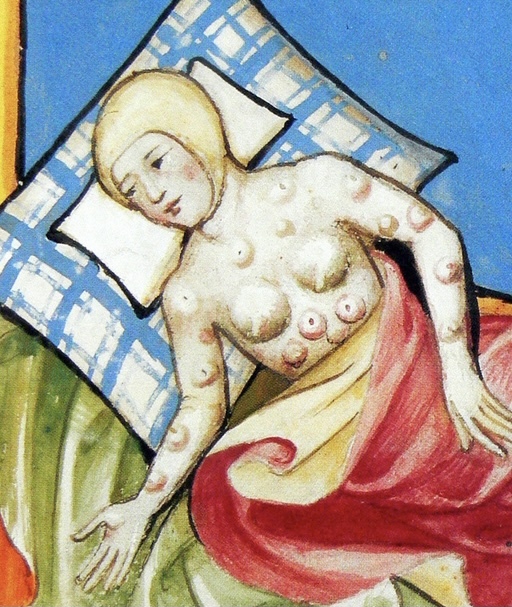 How do I prevent someone from dying of the black plague?