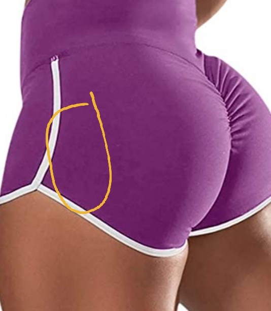Which butt muscle is this (not my butt)?