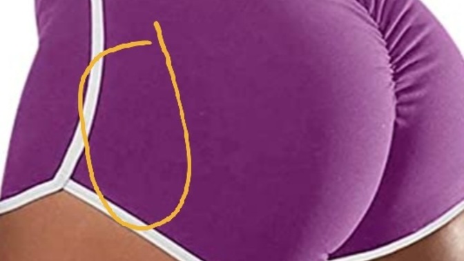 Which butt muscle is this (not my butt)?