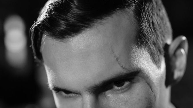Could a scar make a man more attractive?