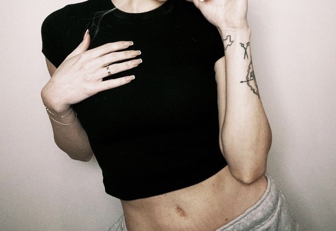Is that stretch marks or what is that she has on her stomach?