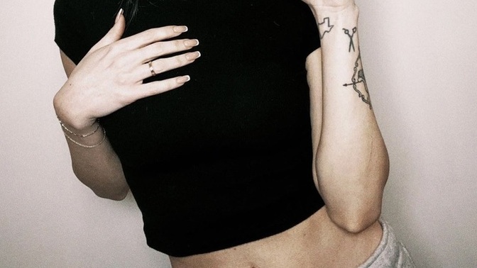Is that stretch marks or what is that she has on her stomach?