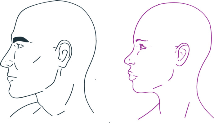 Are women with browridges more attractive?
