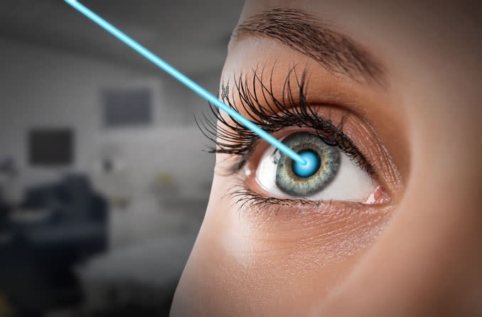 Would you rather your partner in crime where glasses, eye contacts or get LASIK eye surgery?