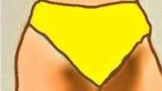 Why do I get dark spots at my inner thighs and buttocks?