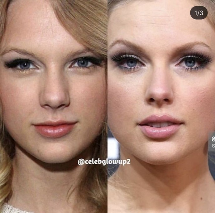 What do you think about women who undergo plastic surgeries to look better?