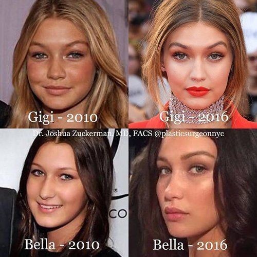 What do you think about women who undergo plastic surgeries to look better?