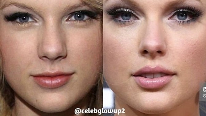What do you think about women who undergo plastic surgeries to look better?