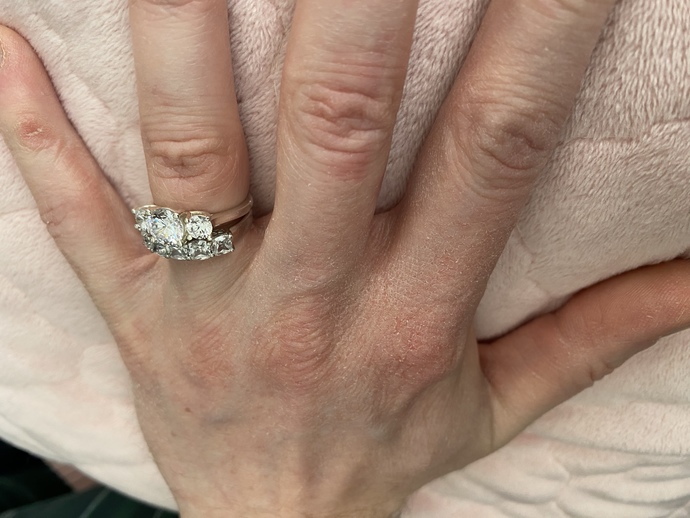 rings and nails?
