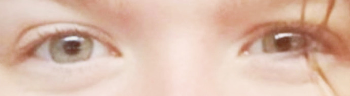 What is the colour of your eyes 👀?