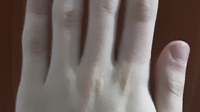 I'm an alpha, but I'm not confident enough about my hand?