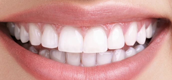 How yellow is too yellow when it comes to teeth in a potential partner?