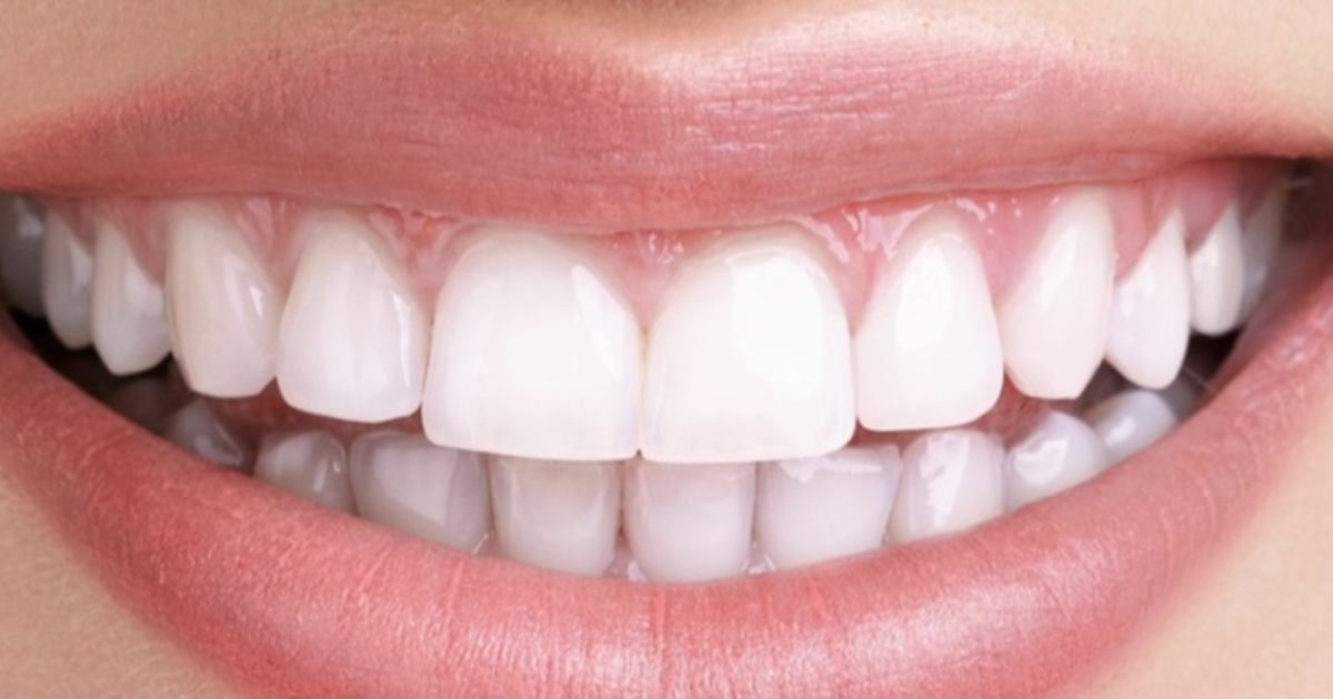 How yellow is too yellow when it comes to teeth in a potential partner