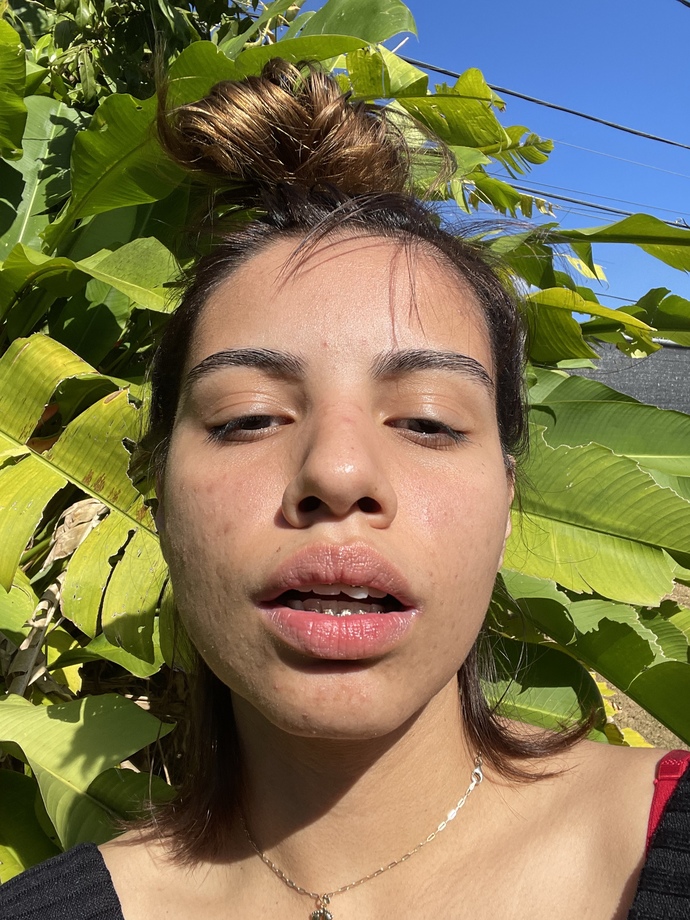 Guys, Which face mask is good for my terrible skin? GirlsAskGuys