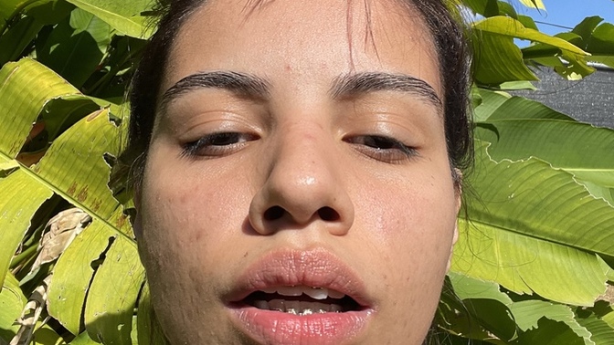 Guys, Which face mask is good for my terrible skin?