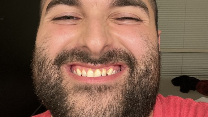 I gained 60 pounds yesterday and got injured by a car accident. Do I look good for Bumble and Tinder?