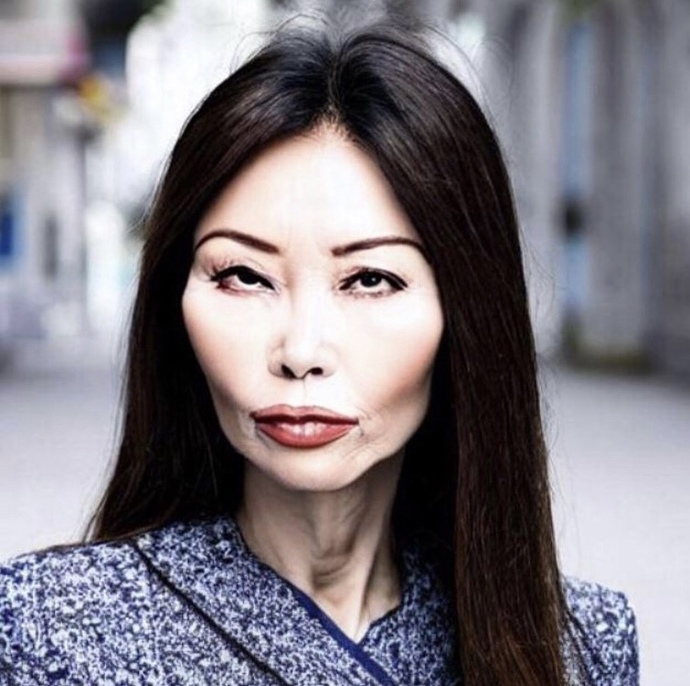 Do you think this Asian lady had plastic surgery / cosmetic procedures?