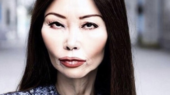 Do you think this Asian lady had plastic surgery / cosmetic procedures?