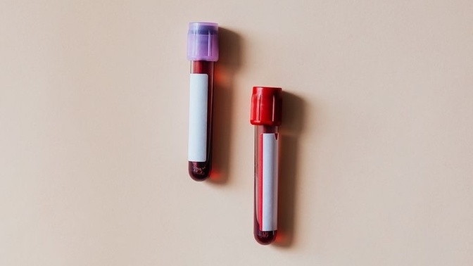 What’s your blood type?