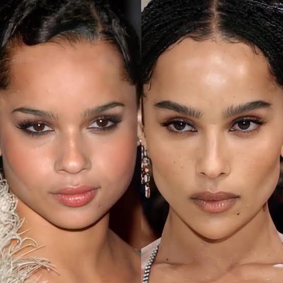 What do you think about this Hollywood trend...  buccal fat removal  ?