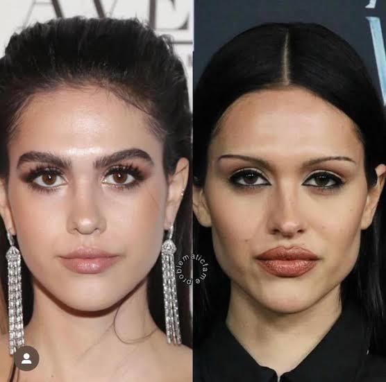 What do you think about this Hollywood trend...  buccal fat removal  ?