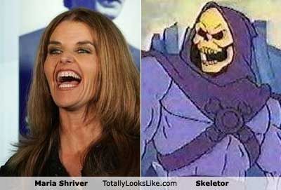 What do you think about this Hollywood trend... " buccal fat removal " ?