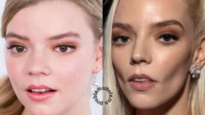 What do you think about this Hollywood trend... " buccal fat removal " ?