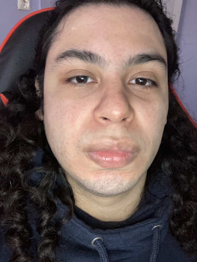 What do people have against big lips?
