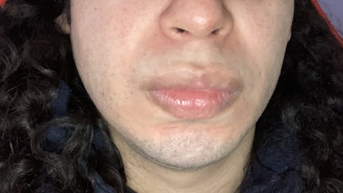 What do people have against big lips?