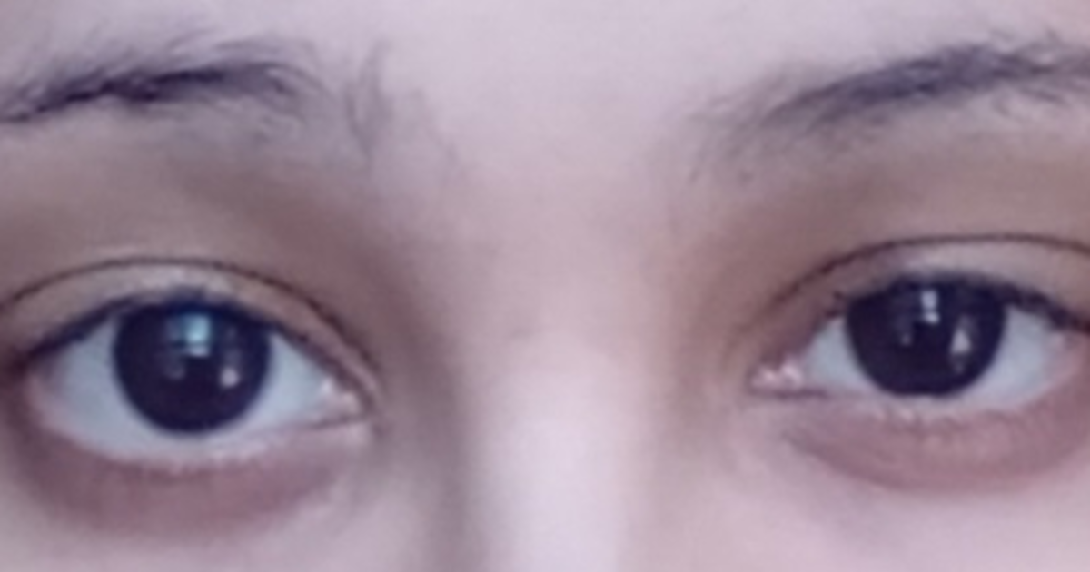 Are my eyes small, medium, or big? And dose anybody know that shape of