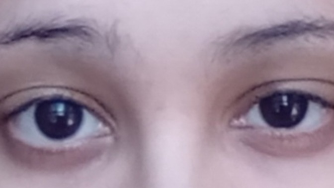Are my eyes small, medium, or big? And dose anybody know that shape of my eye's?