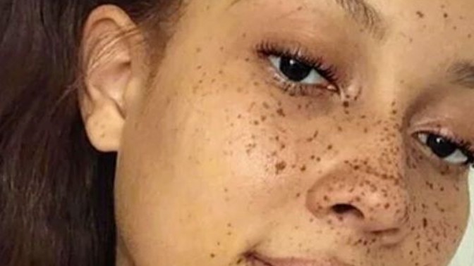 What do guys think of girls with freckles?