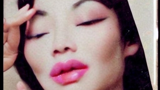Was this a good result for cosmetic procedures in 90s?