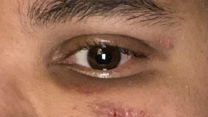 Men with scars on face?