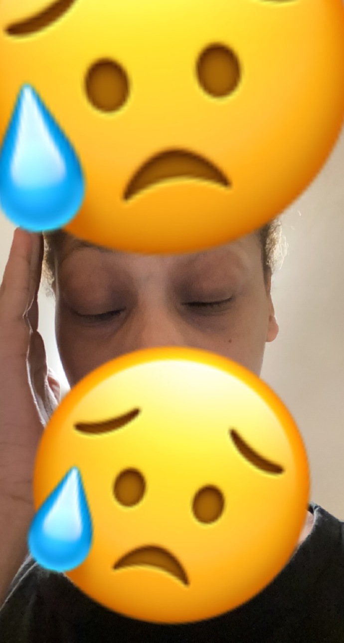 How could I get rid of my dark circles and my lines?