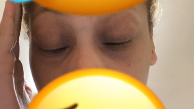 How could I get rid of my dark circles and my lines?