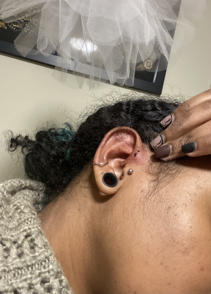 The raised skin is where the ball is 