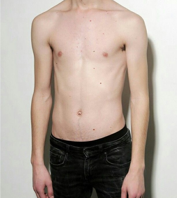What bodytype do you PREFER in a romantic partner?