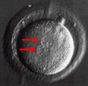 Do you care that Mifepristone, the abortion drug, has been banned?