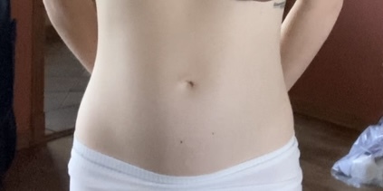 Does this seem like diastasis recti (ab separation)?