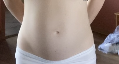 Does this seem like diastasis recti (ab separation)?