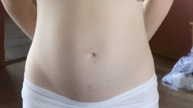 Does this seem like diastasis recti (ab separation)?
