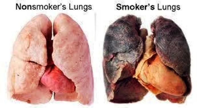 Is smoking cigarettes good for you?