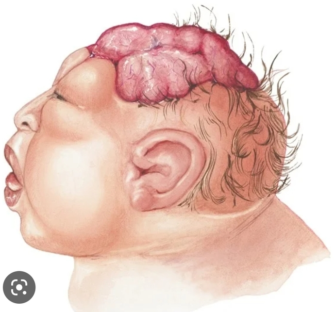 If you (or your partner) was pregnent and the child is severly sick and WILL die within a month after birth. Would you abort it?